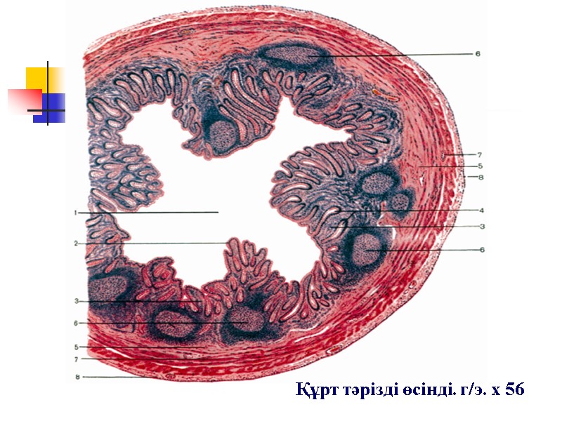 Құрт тәрізді өсінді. г/э. х 56